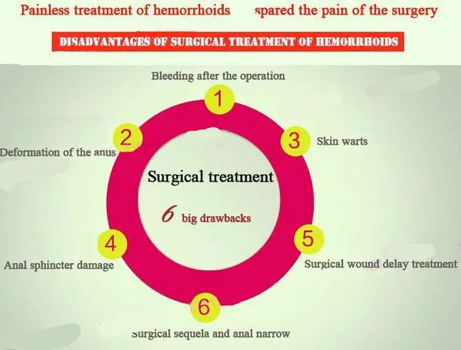 ZB геморрой мазь растительный травяной материал мощный крем от геморроя