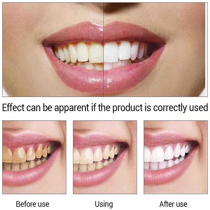 

Teeth Whitening Essence Serum Powder Oral Hygiene Cleansing Remove Plaque Stains Fresh Breath Oral Hygiene Dental Tools