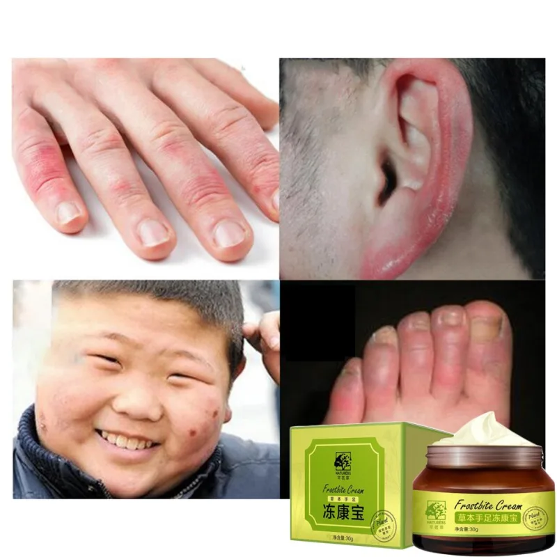 Крем для ног с экстрактом трав рук увлажняющий крем против трещин обморожения и