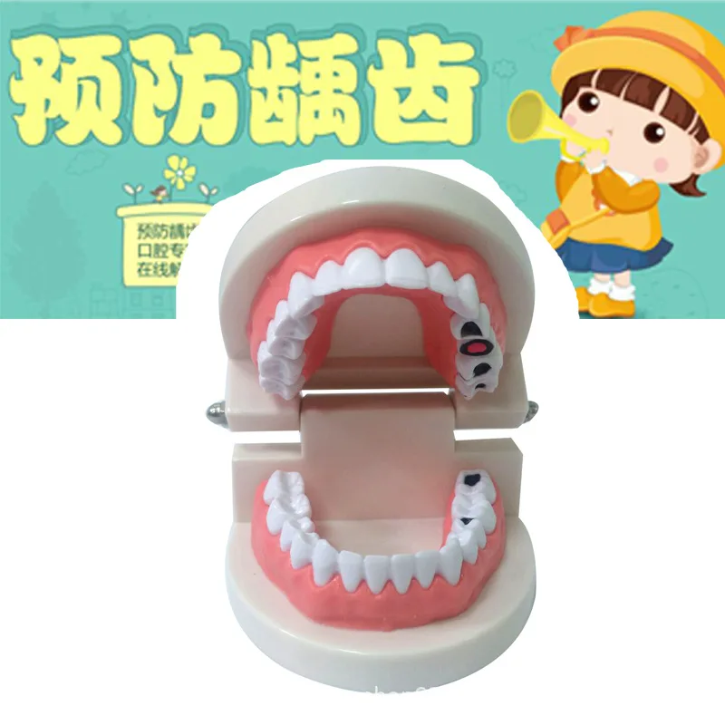 ABS PVC Dental Model Oral Instrument Tools Consumables Tooth Decay Medical Care Teaching Aids Teeth | Канцтовары для офиса и