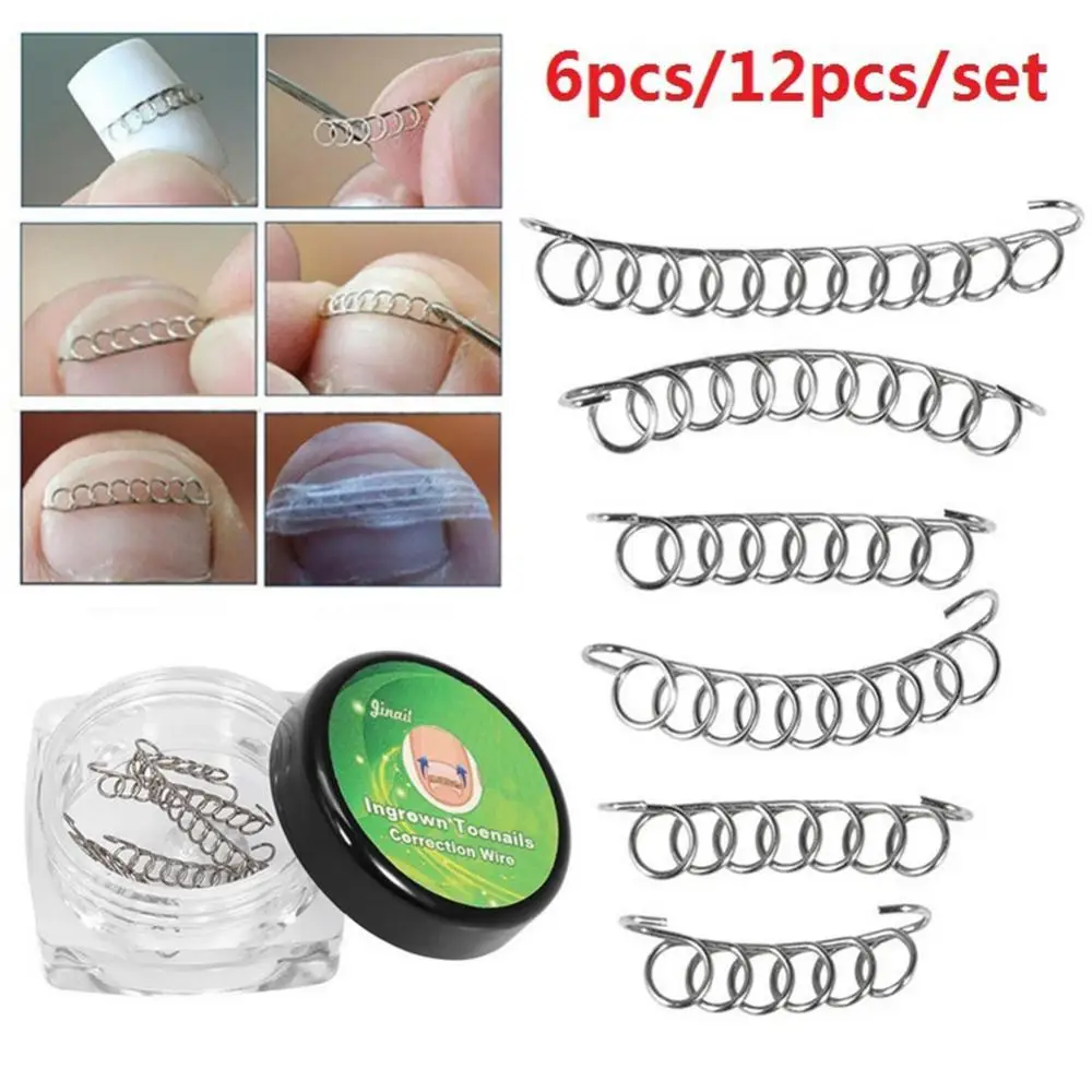 

50% Hot Sale 6/12Pcs Ingrown Toenail Correction Wire Fixer Foot Care Pedicure Recover Tool
