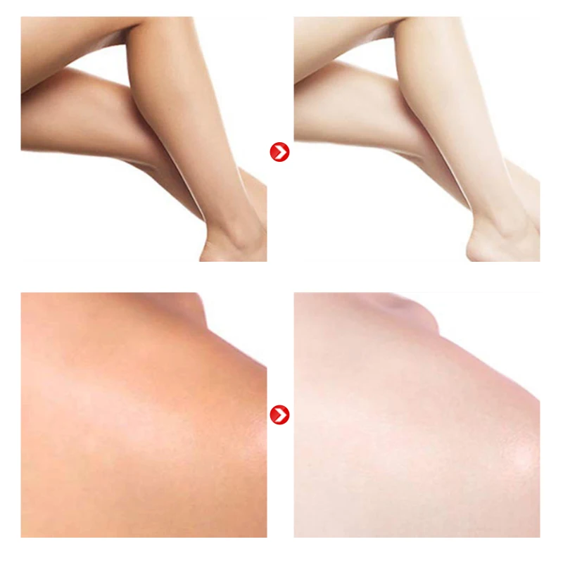 

Whitening Cream Bleaching Face Body Lightening Cream Underarm Armpit Whitening Cream Legs Knees Private Parts Body White TSLM1