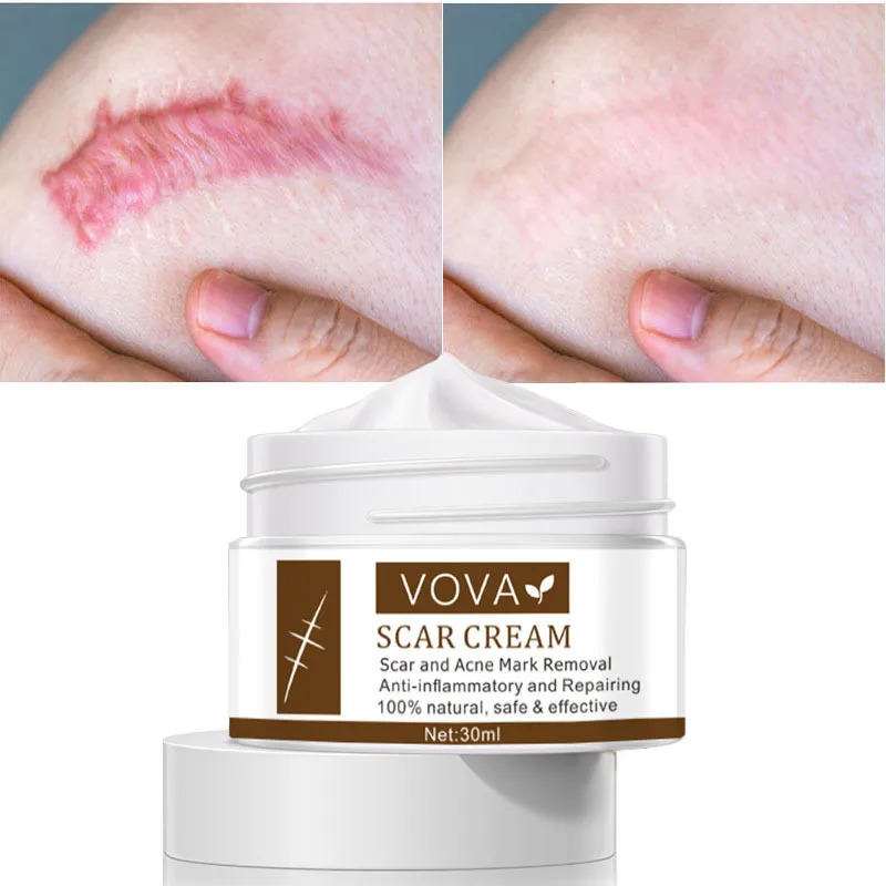 VOVA Scar Removal Cream Remove Scars Stretch Mark Anti Inflammatory Body Skin Pigmentation Corrector Acne Spots Repair Care 30ml