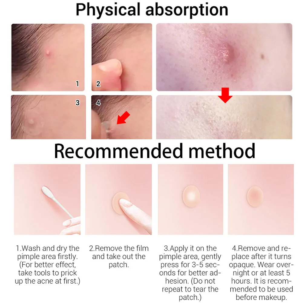 Пластырь для ухода за кожей чайного дерева пластырь от акне прыщиков невидимые