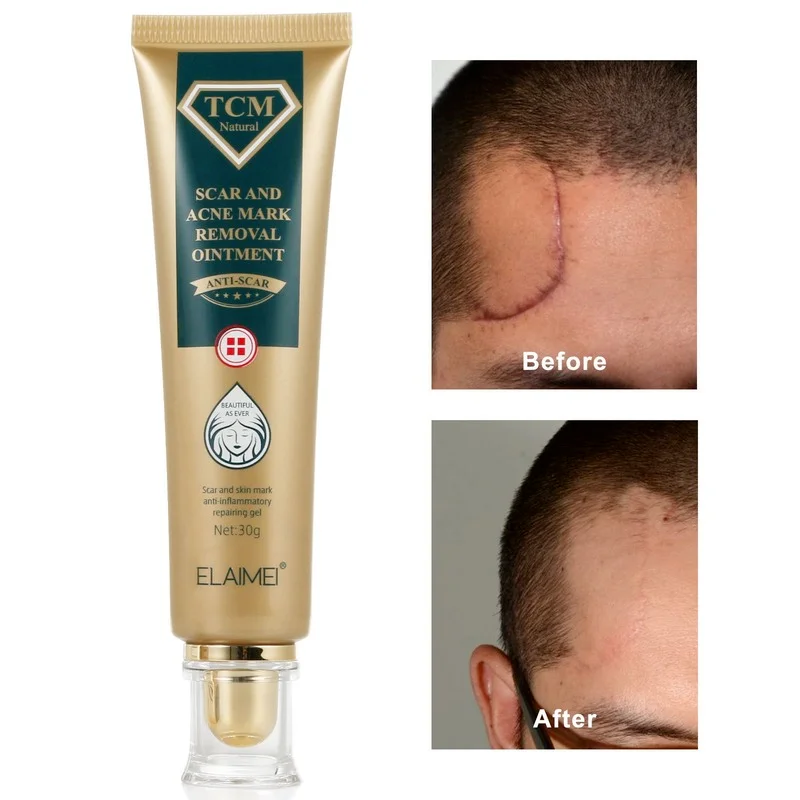 

ELAIMEI Acne Scar Removal Cream Pimples Stretch Marks Face Gel Remove Smoothing Whitening Moisturizing Body Skin Care Aichun
