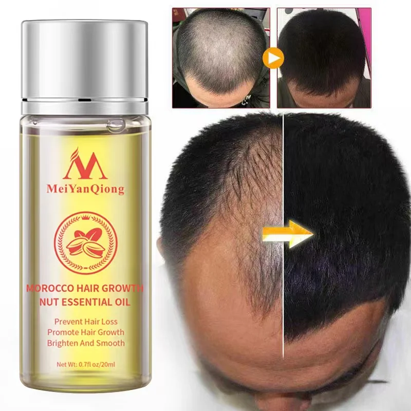 

Moroccan Hair Growth Essential Oil Serum Hair Care Products Prevent Hair Loss Treatment Straighten Repair Damaged Beauty Health