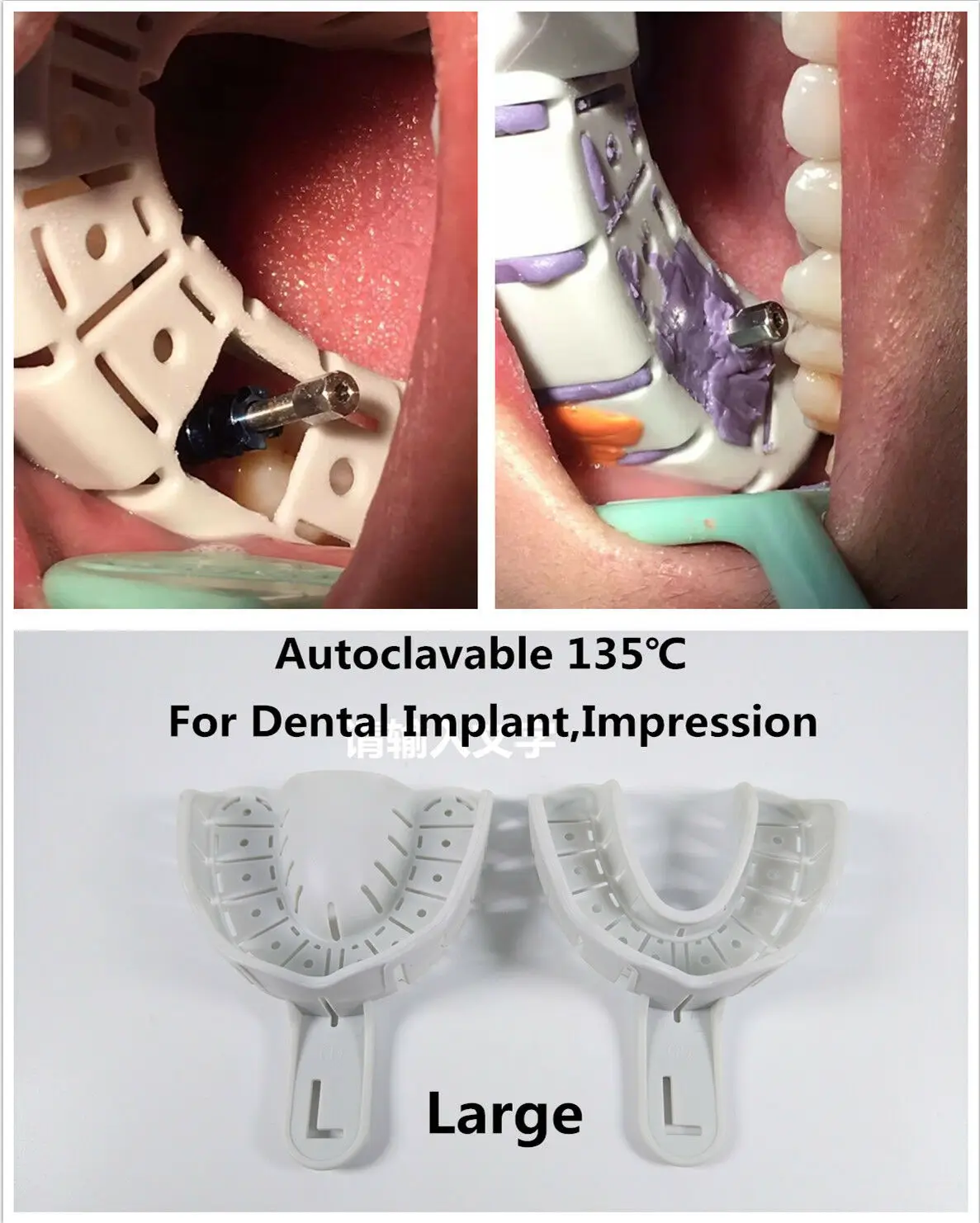 

Dental Plastic Impression Trays Large Autoclavable Perforated For Impalnt Post