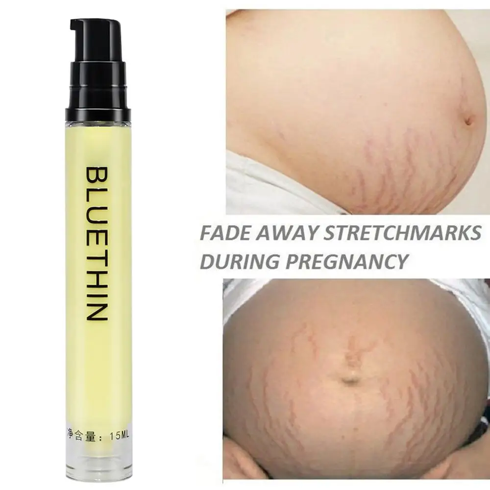 Remove Pregnancy Scars Acne Cream Maternity Repair Anti-Aging Anti Winkles Firming Body Creams Remove Stretch Marks Cream