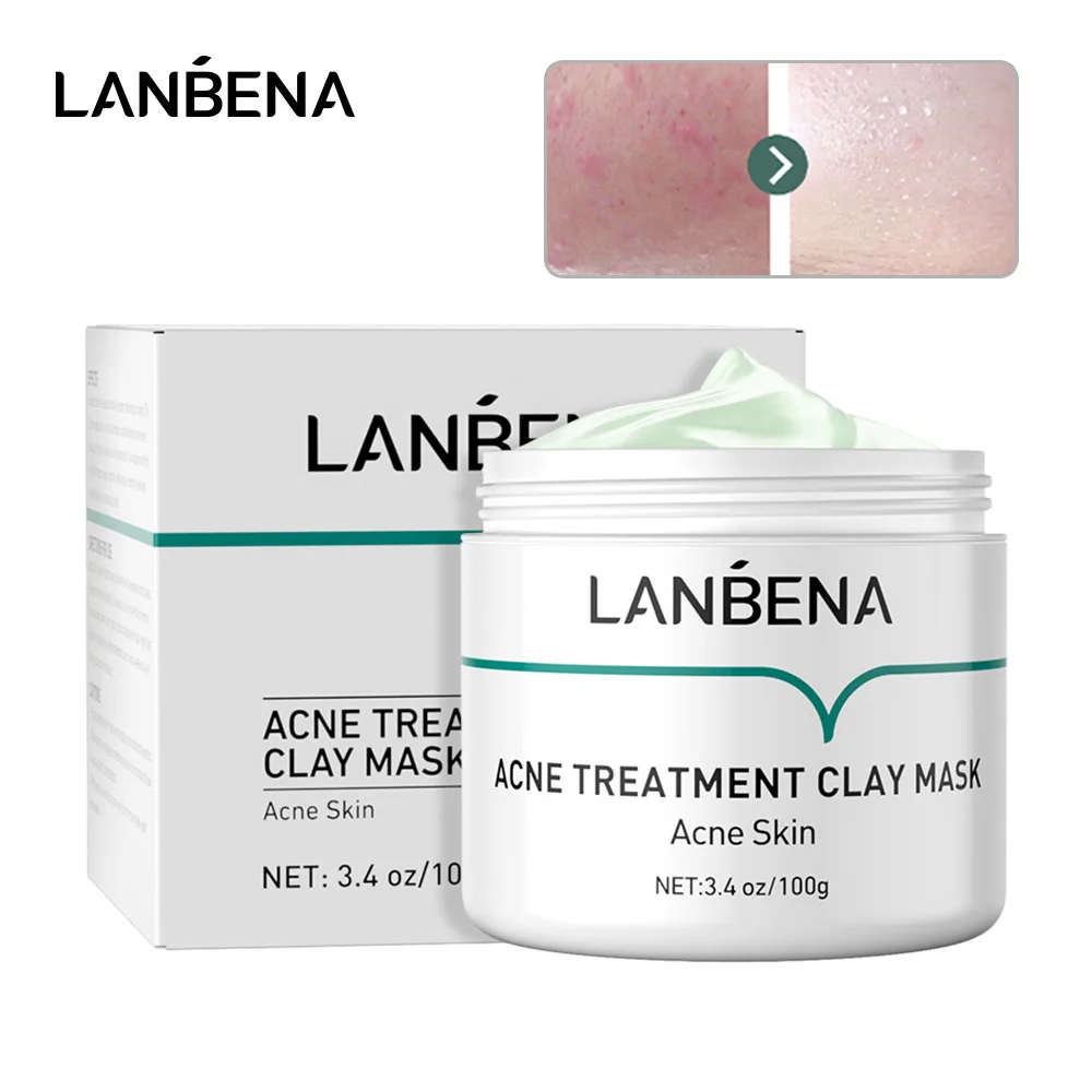 

LANBENA Acne Mud Mask To Remove Oil And Acne Cleansing Shrinking Pores Visibly Smooth Refine Skin Texture Korean Face Maks100G