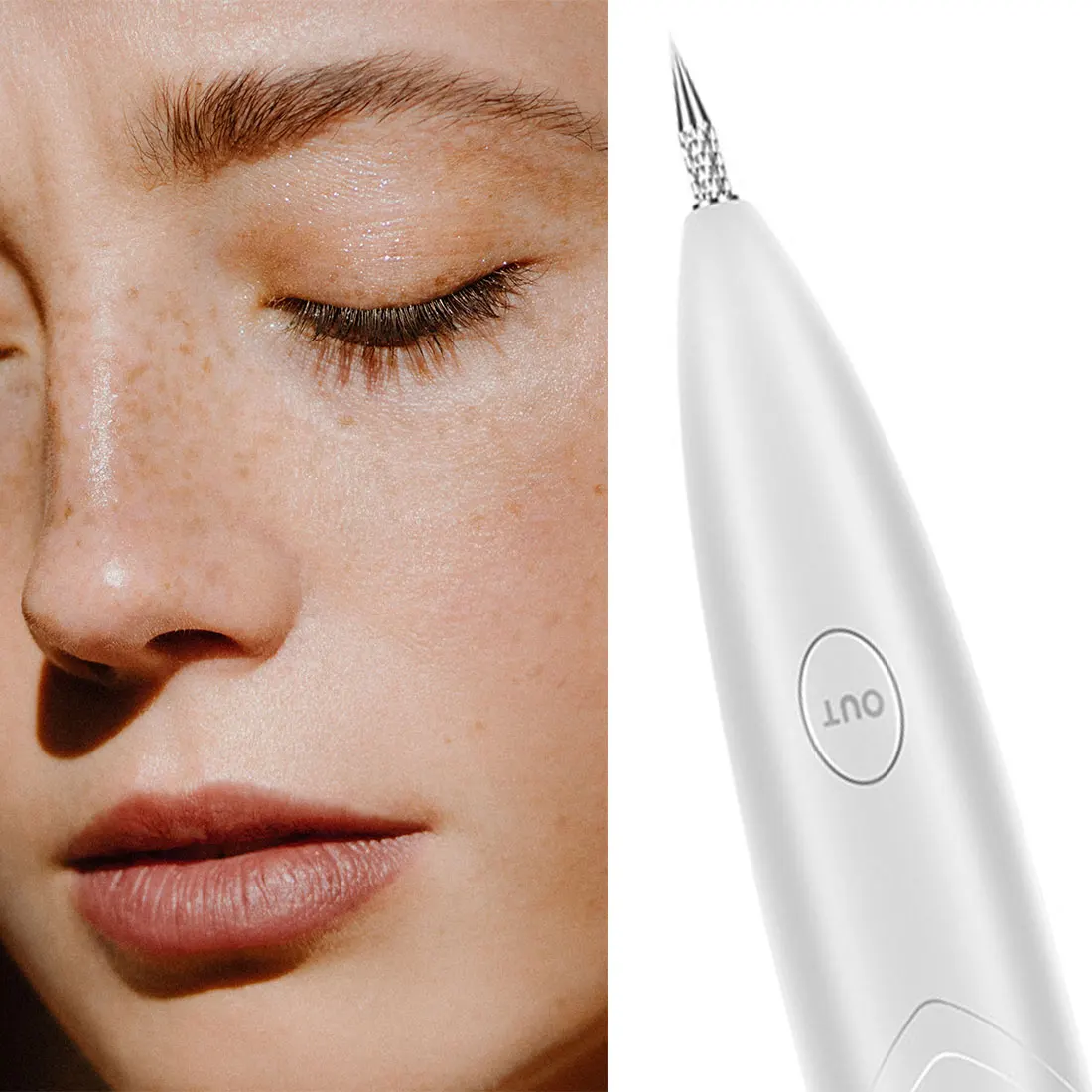 Новинка плазменное устройство для удаления татуировок родинок этикетка кожи