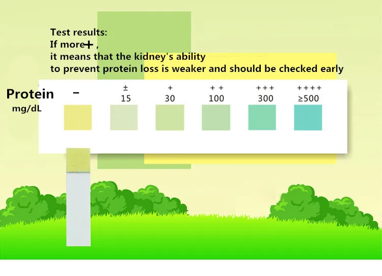 Тест полоска на мочу 25 шт./компл. точность при проверке функции жирной почки