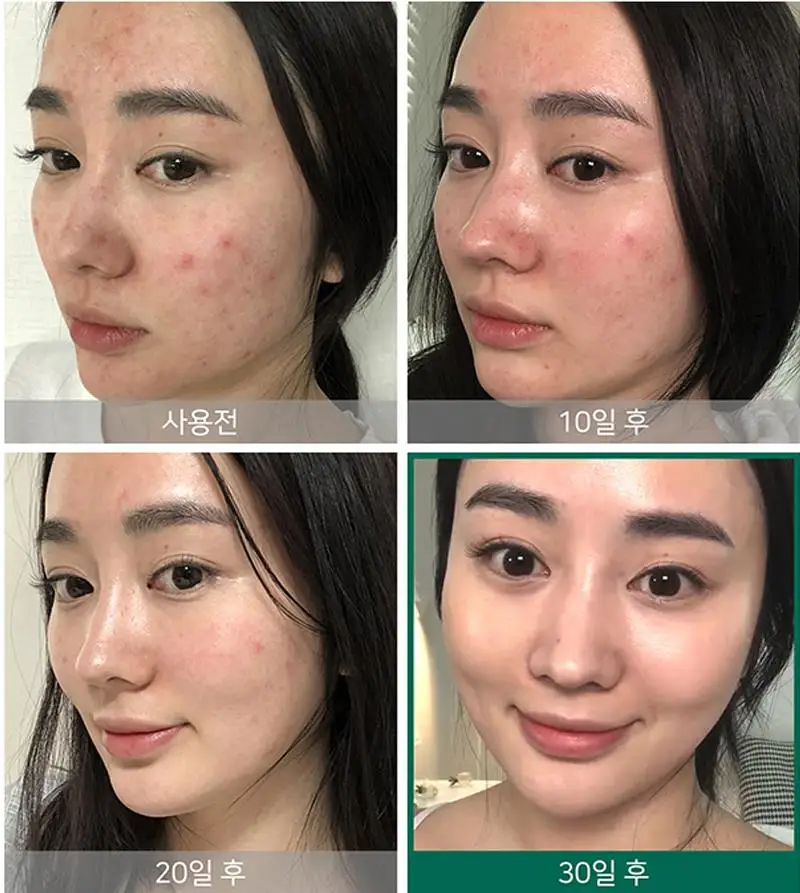 

Truecica Miracle, 50