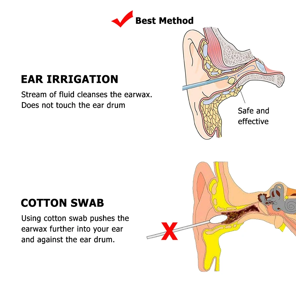 

Ear Irrigation Cleaning Kit Ear Wax Removal Kit With Ear Washing Syringe Squeeze Bulb Earwax Remover for Adults Kids Ear Care