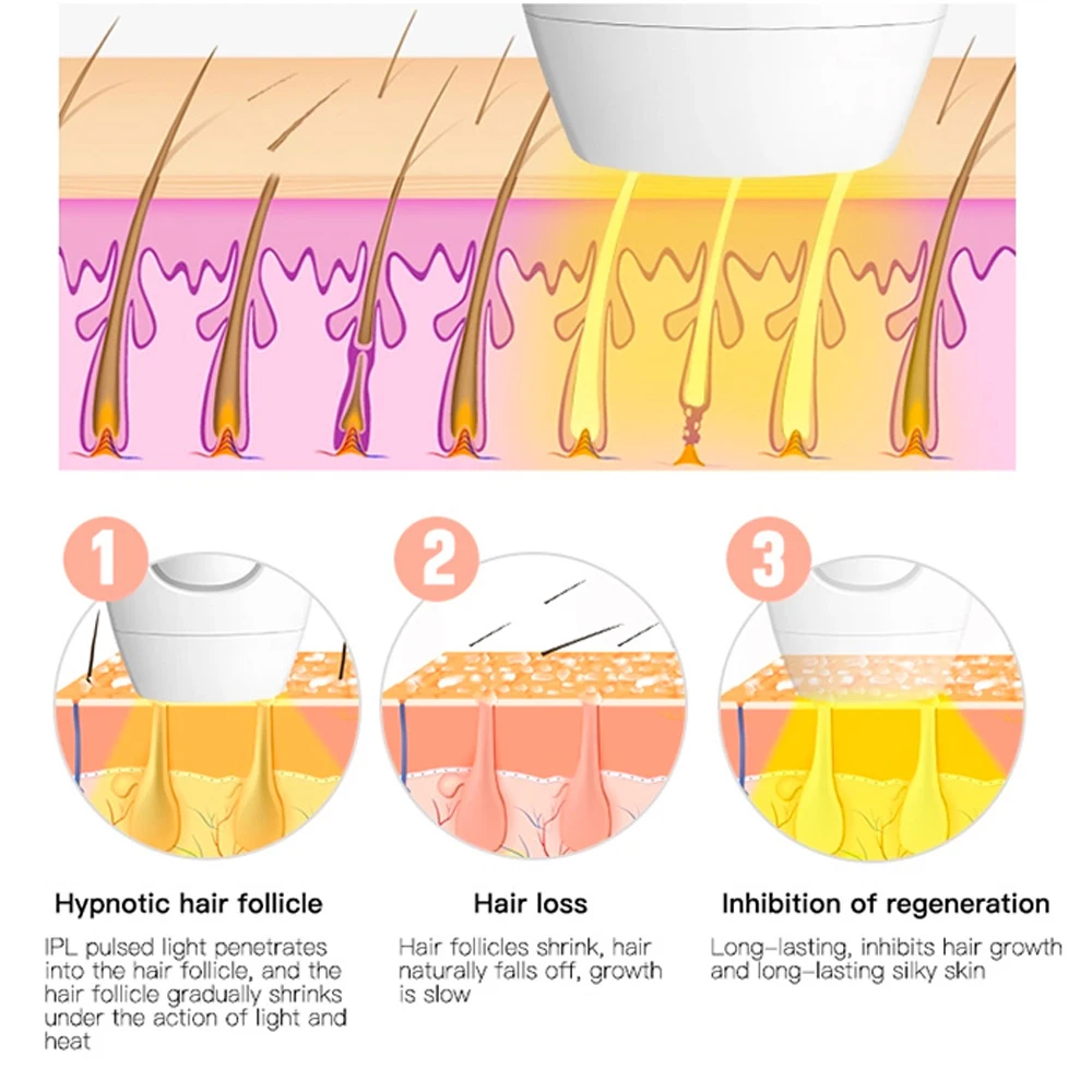 Лазерный эпилятор на 600000 вспышек аппарат для перманентного удаления волос IPL