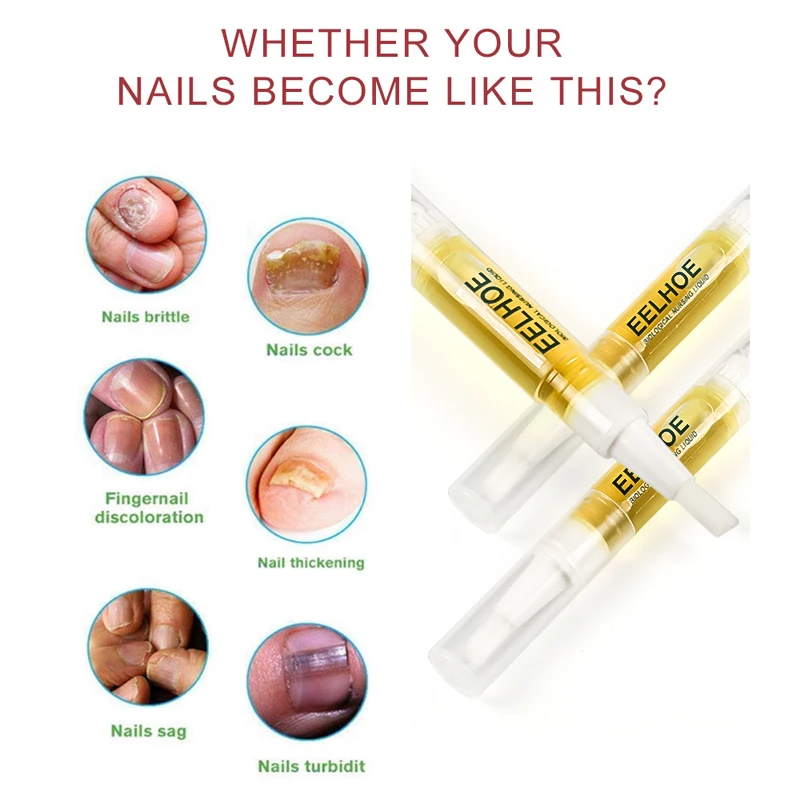 1/2 шт. антигрибковая жидкость для ногтей | Красота и здоровье