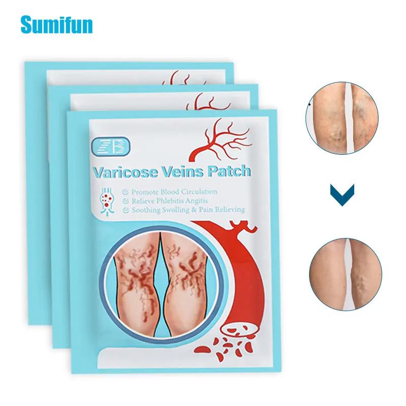 

6/12Pcs Varicose Veins Plaster Vasculitis Phlebitis Spider Leg Treatment Herbal Chinese Medical Patch Angiitis Removal Sticker