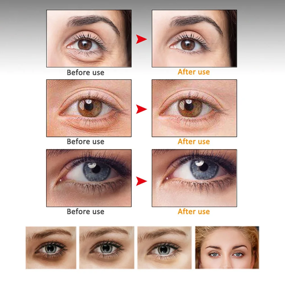 Сыворотка для области вокруг глаз с витамином Е 30 мл| |