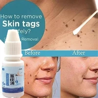 genital wart treatment papillomas removal of warts liquid from skin band aid removing against moles remover anti verruca remedy