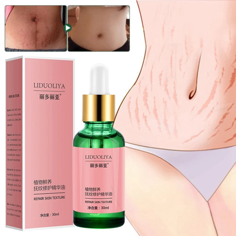 Чистое Натуральное удаление растяжек эфирные масла растяжки для удаления