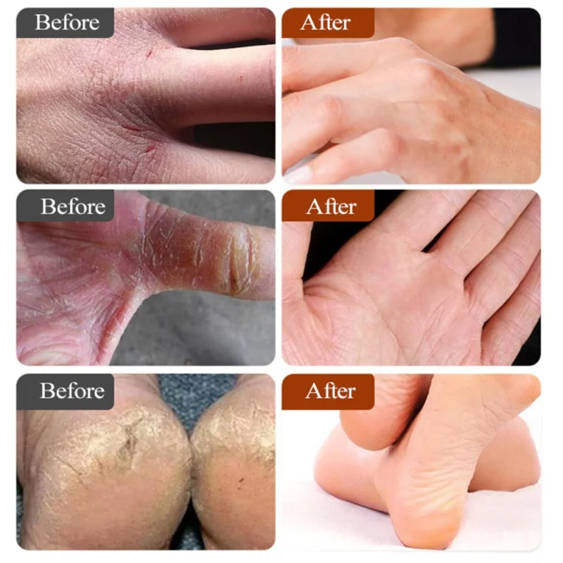 Конский масляный крем от трещин пятки для рук пилинг стопы ремонт анти сухой мазь