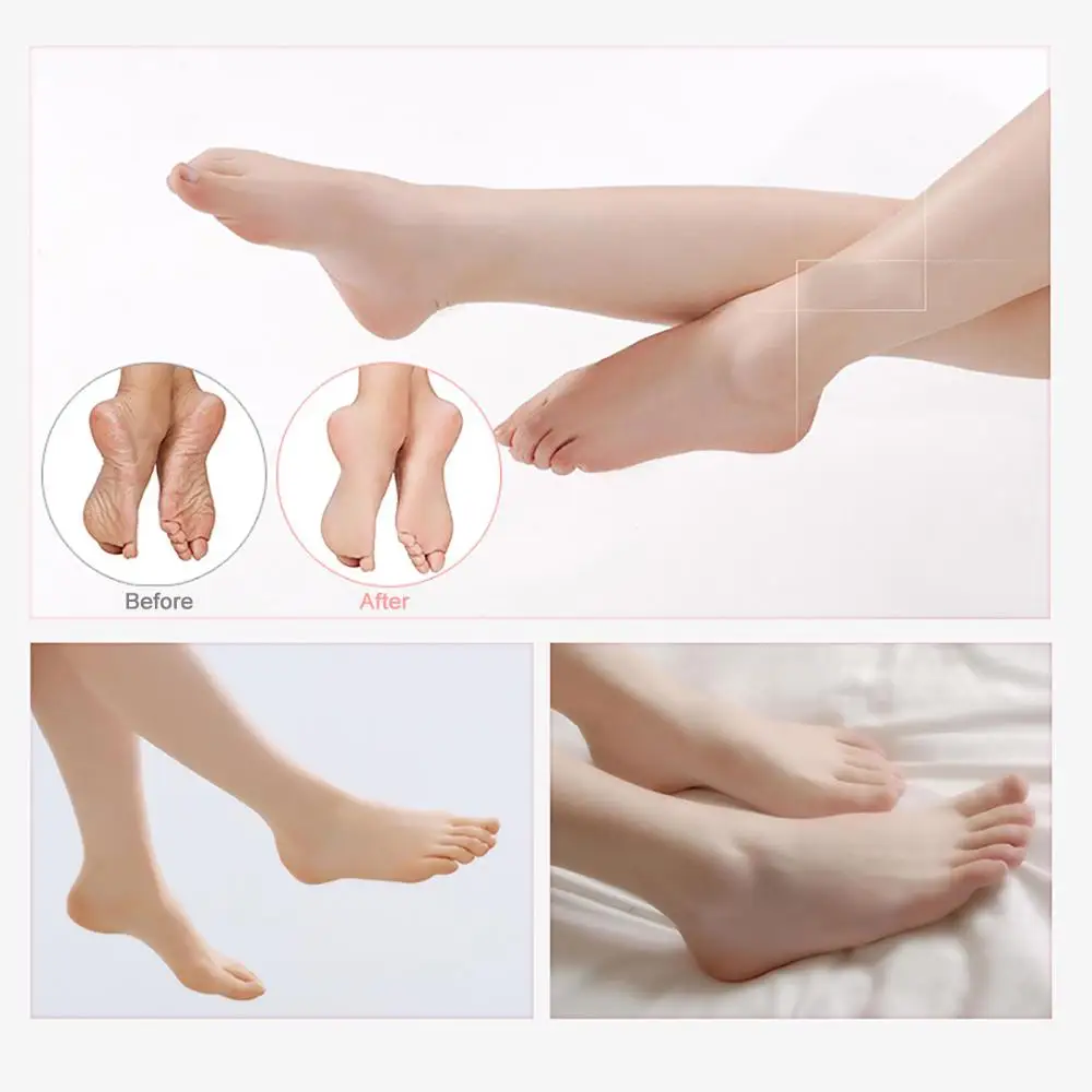 2 шт./пара каблука Носки унисекс массаж увлажняющее отбеливание удалить мертвая