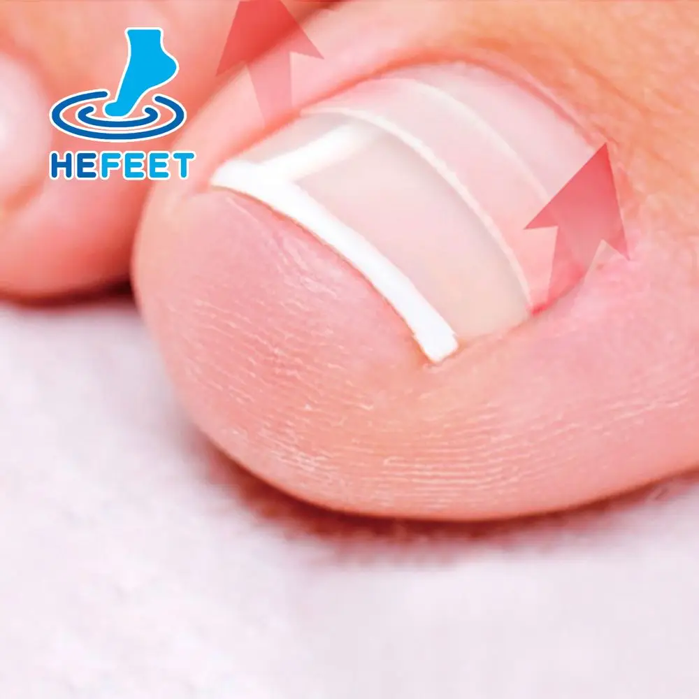 

10 шт., профессиональные наклейки для выпрямления ногтей