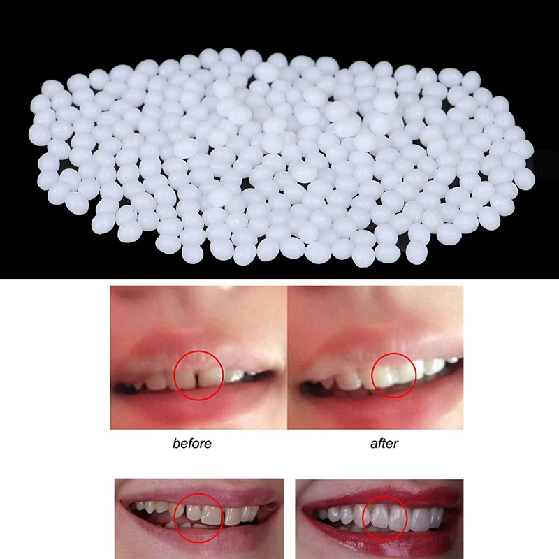 

5/10/15/20g Adhesive Teeth Whitening Temporary Tooth Repair Kit Teeth And Gaps FalseTeeth Solid Glue Denture Tooth Beauty Tool