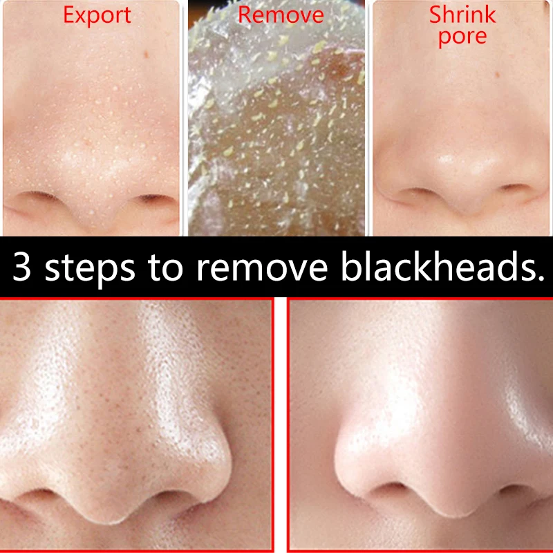 Три набора для удаления угрей ламилее прополиса маска носа лица черная головка