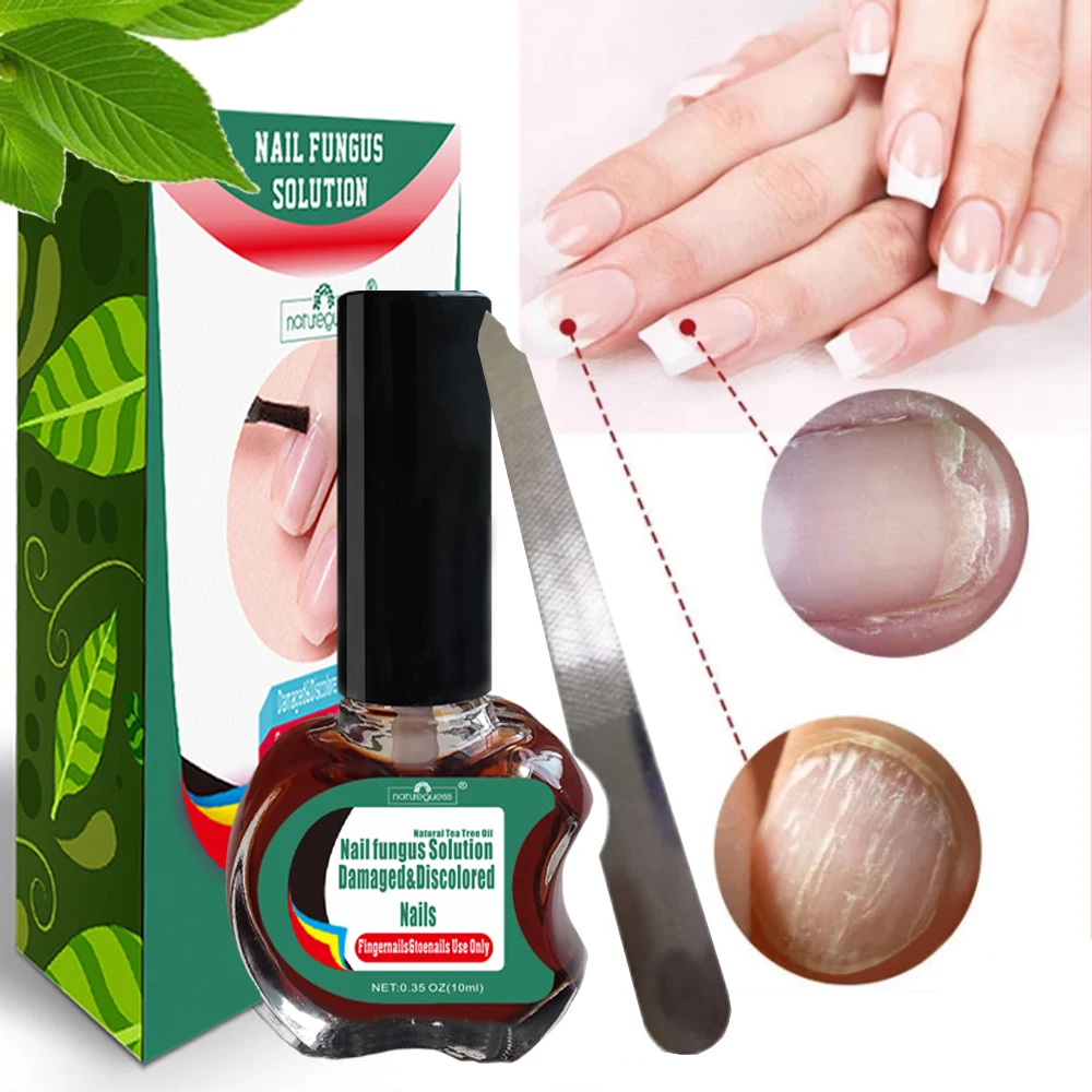 Грибковая Сыворотка для ногтей эссенция противоинфекции боронихия средство