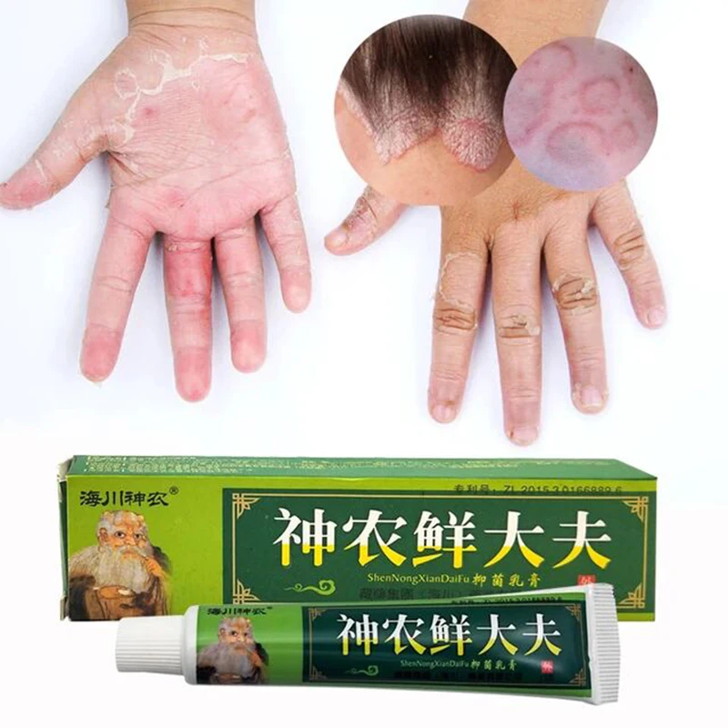 

15 г, натуральная китайская медицина, травяное средство против бактерий, лечение экземы, высококачественный травяной крем