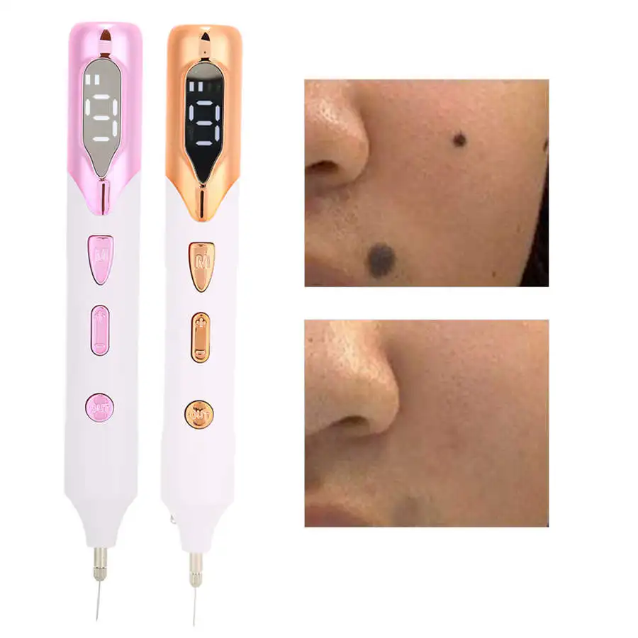 Mole ручка для удаления черных точек вакуумная USB 9 передач Регулировка темных