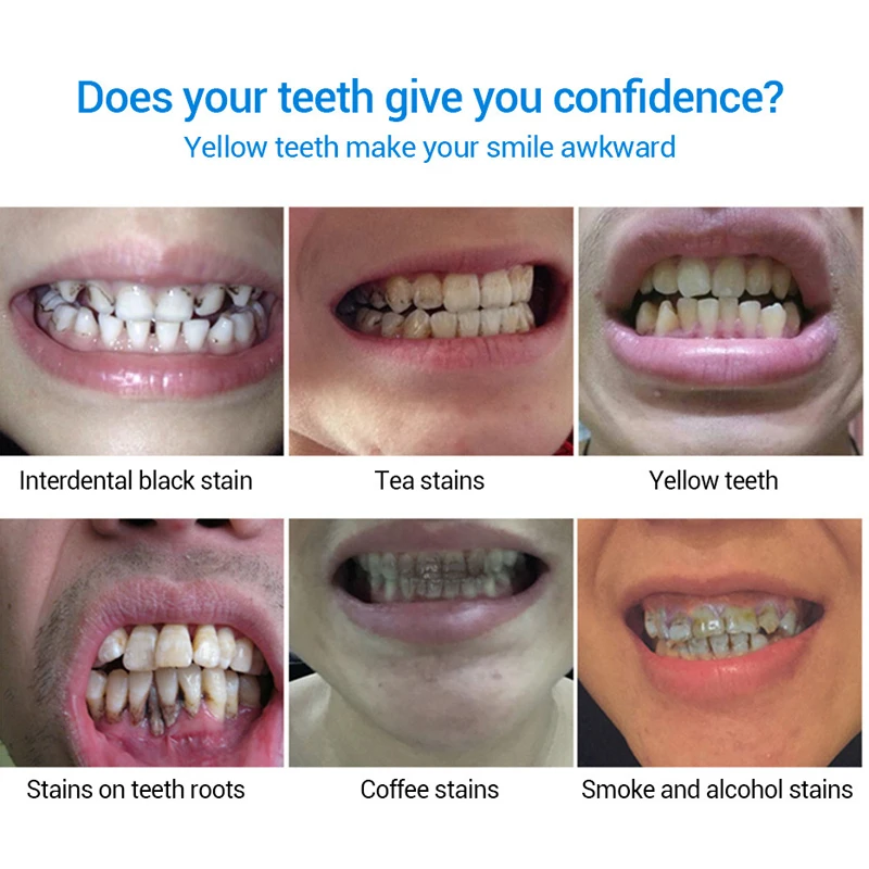 Гель-сыворотка для отбеливания зубов 10 мл | Красота и здоровье