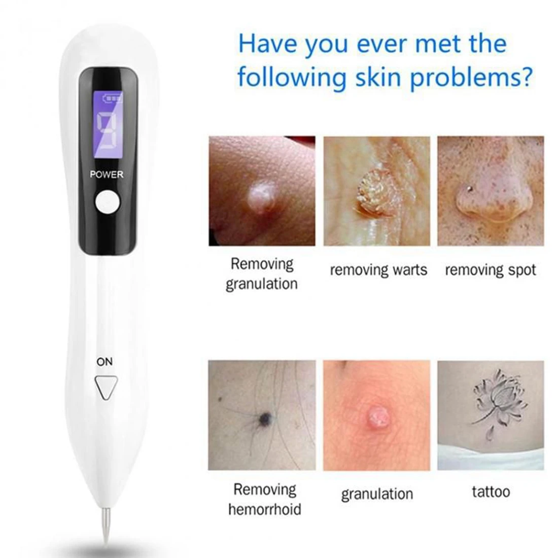 

LCD Plasma Pen Laser Tattoo Mole Removal Machine Rechargeable Face Care Skin Tag Removal Freckle Wart Dark Spot Remover