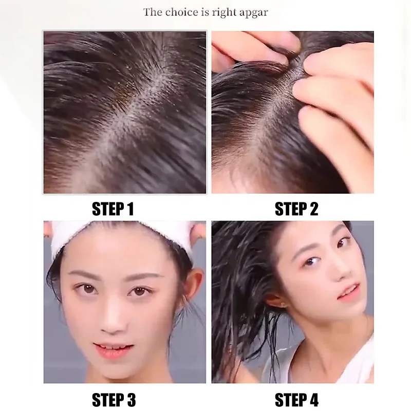 

Fashion Hair Growth Essence Oil Hair Loss and Hair Thinning Treatment Hair Stops Balding Repairs Hair Follicles Thickening Hair