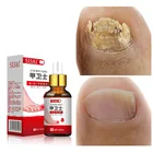 Лечение грибка ногтей эфирное масло уход за ногами отбеливающий гель для удаления грибка ногтей против инфекции эссенция для восстановления рук и ног
