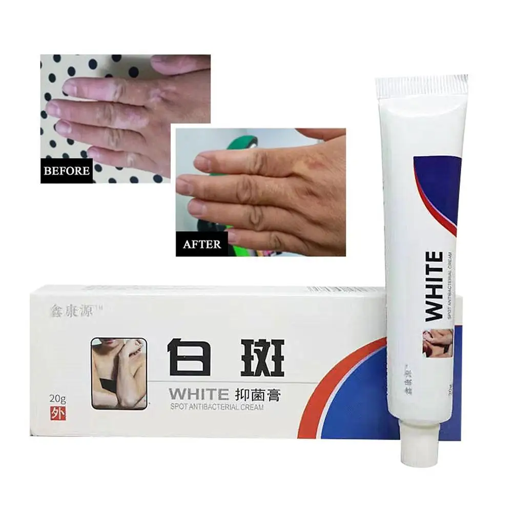Лечебный крем Vitiligo Leukoplakia мазь китайская трава уход за кожей восстановление