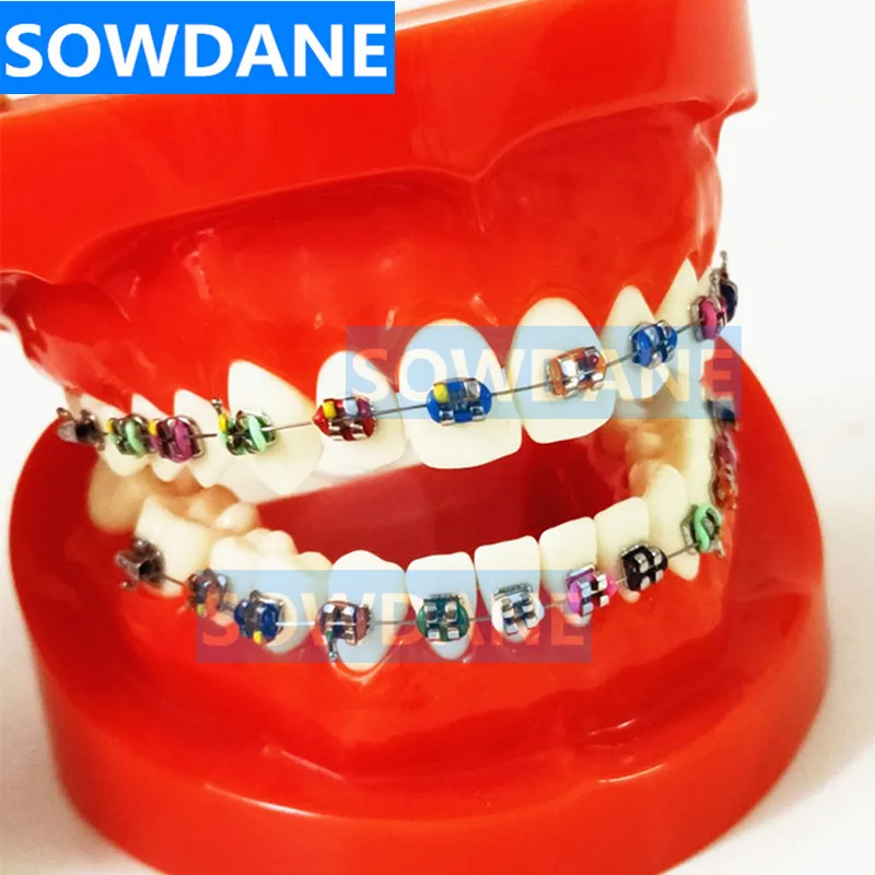 Стоматологическая Ортодонтическая обучающая модель с ортодонтическим