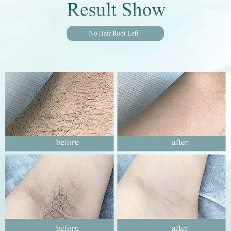 

IPL Lasers-Hair Removal Machine Permanent Epilator Painless Hair Removal Device Bikini Trimmer EU Plug