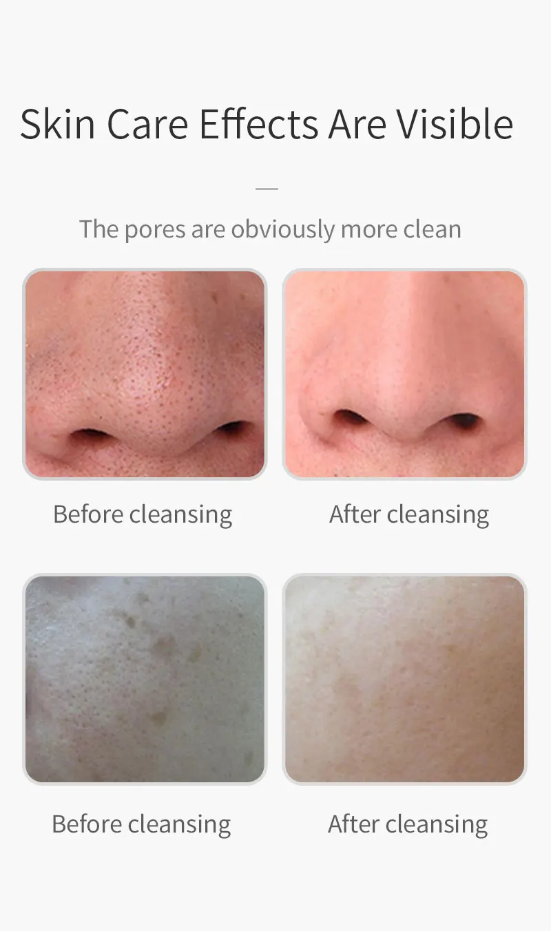 Ultrasonic Shovel Pore Cleaner Foreo Beauty Skin Care EMS Pulse Micro Electric Apparatus Belleza Facial TSLM1 | Красота и здоровье