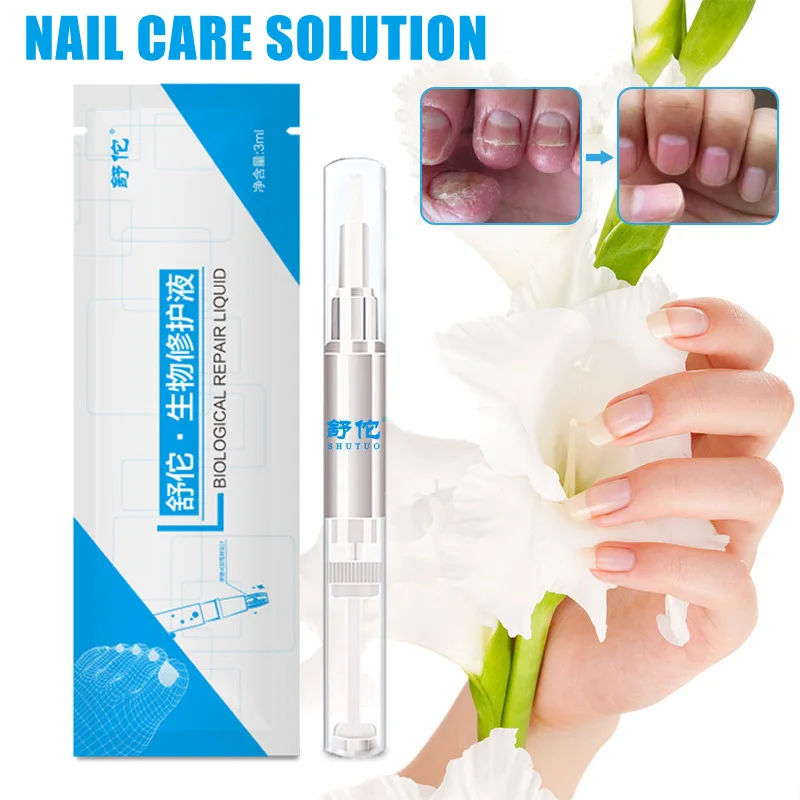3ml Nail Fungus Treatment Liquid Anti Fungal Finger Toe Nails Care NShopping