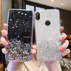 Чехол для Huawei P20 Lite, Huawei P20 Pro, блестящий чехол для телефона Huawei P20 Pro, P20Lite, P 20 Pro, роскошный мягкий чехол из эпоксидной смолы