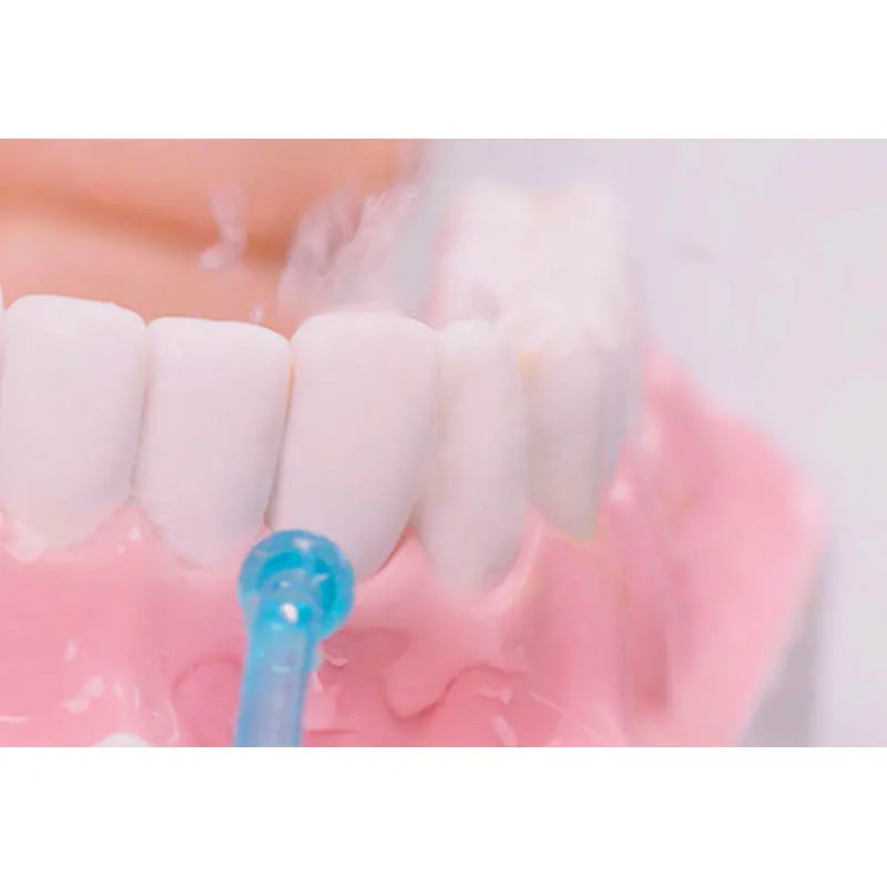 Портативный стоматологический отбеливающий мундштук SOOCAS W3 с водяной струей