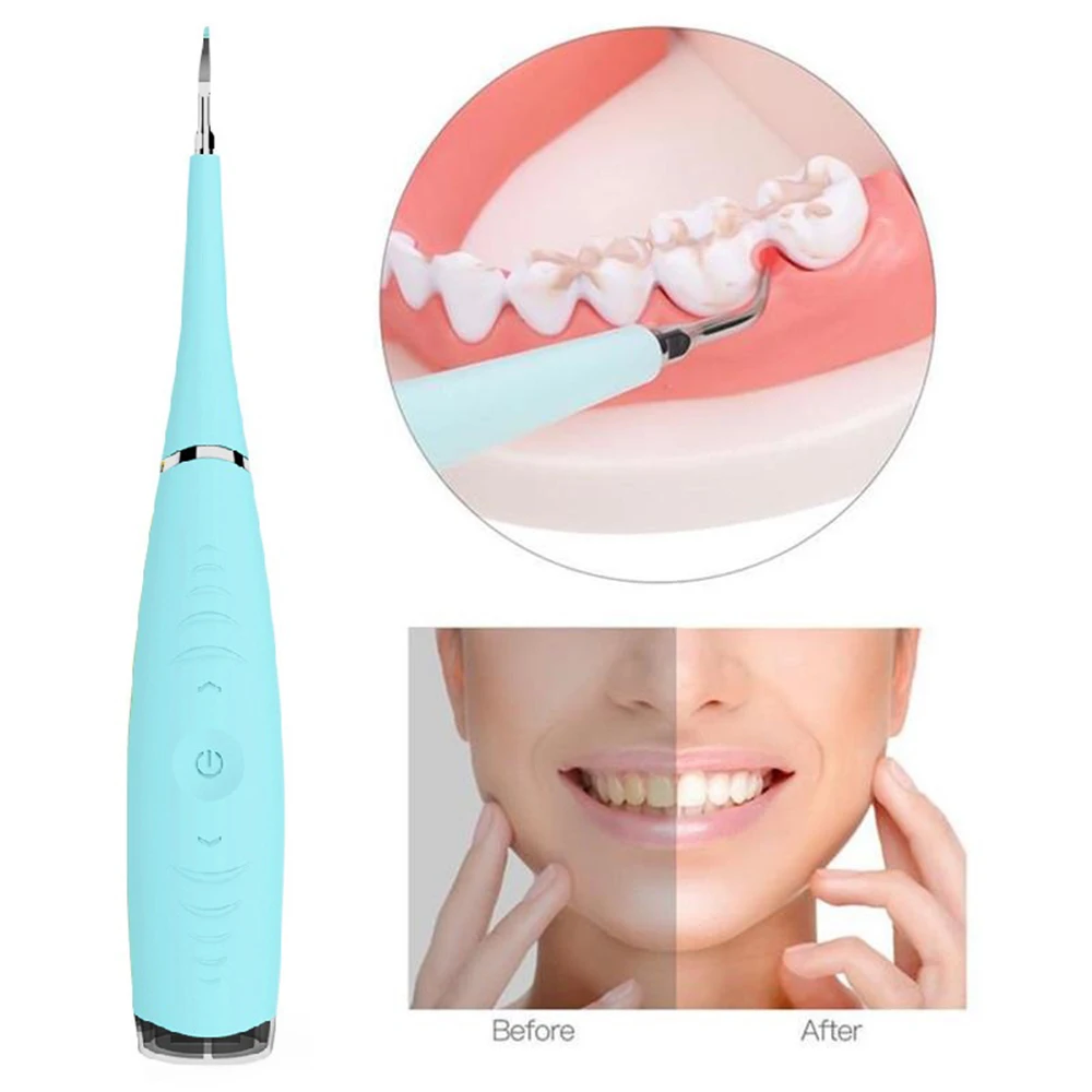 

Electric Tooth Scaler Ultrasonido Dental Tooth Cleaner Teeth Whitening Cleaning Tooth Calculus Remover Teeth Stains Tartar Tool