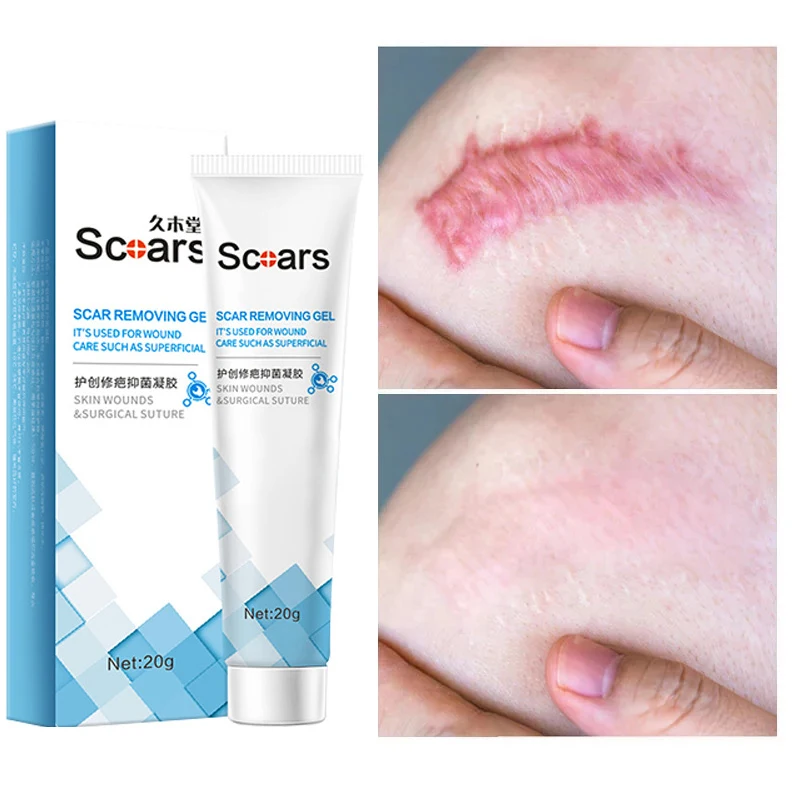 Крем для удаления шрамов от акне прыщей растяжек гель лица сглаживание