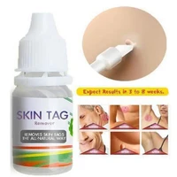 new effective treatment without stimulation 100 natural skin tag removal treatment cream care mole remover wart remover hotsale