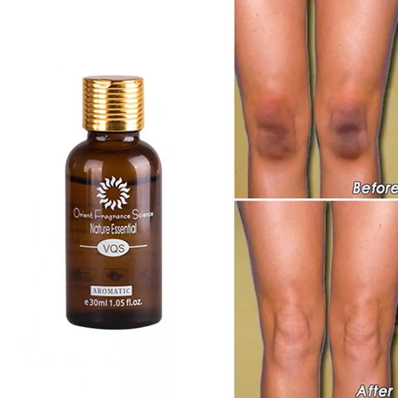 Китайское ультра осветляющее безупречное масло для ухода за кожей темные пятна