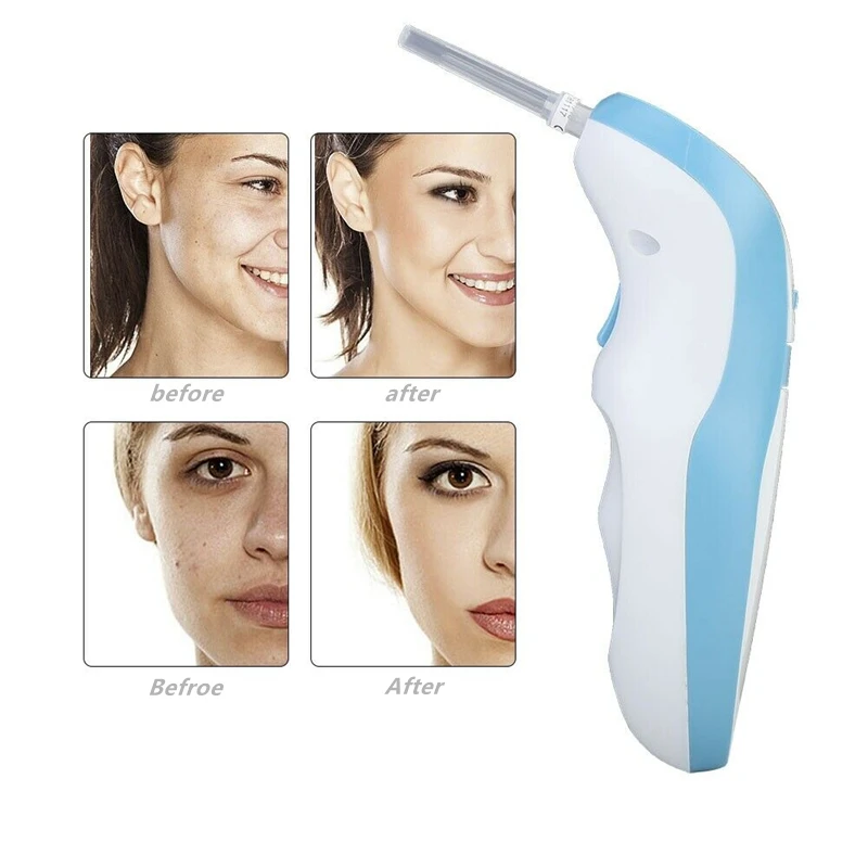 Профессиональная плазменная ручка для подтяжки век лазерная аппарат удаления