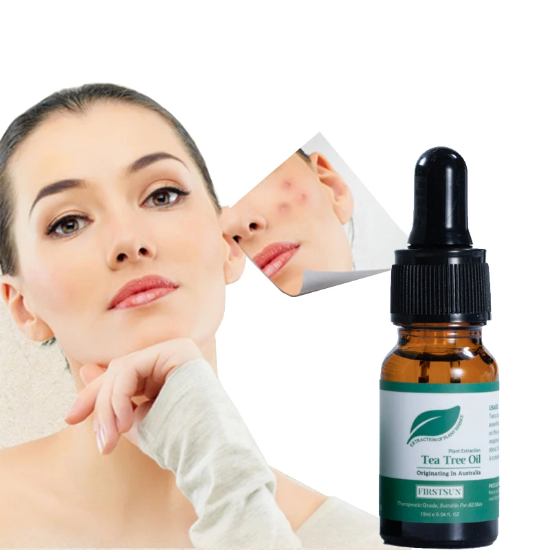 

Repair Acne Skin Tea Tree Extract Facial Essence Remove Pustule Prevent Acne Shrink Pores Face Essential Oil Fade Acne Spots