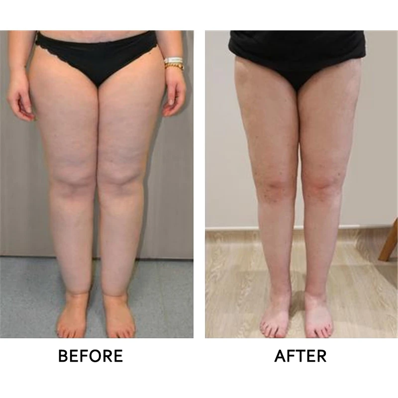 

10 pcs Foot Patch With Ginger And Wormwood Anti-Swelling Detoxification Pain And Stress Relief