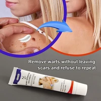 1pcs warts remover antibacterial ointment wart treatment cream skin tag remover genital herpes papillomas treatment ointment